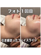 リエル(RIEL)/【フォト】