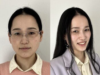 ウル 恵比寿渋谷店(ULU)/透明感アップ！その秘訣は…