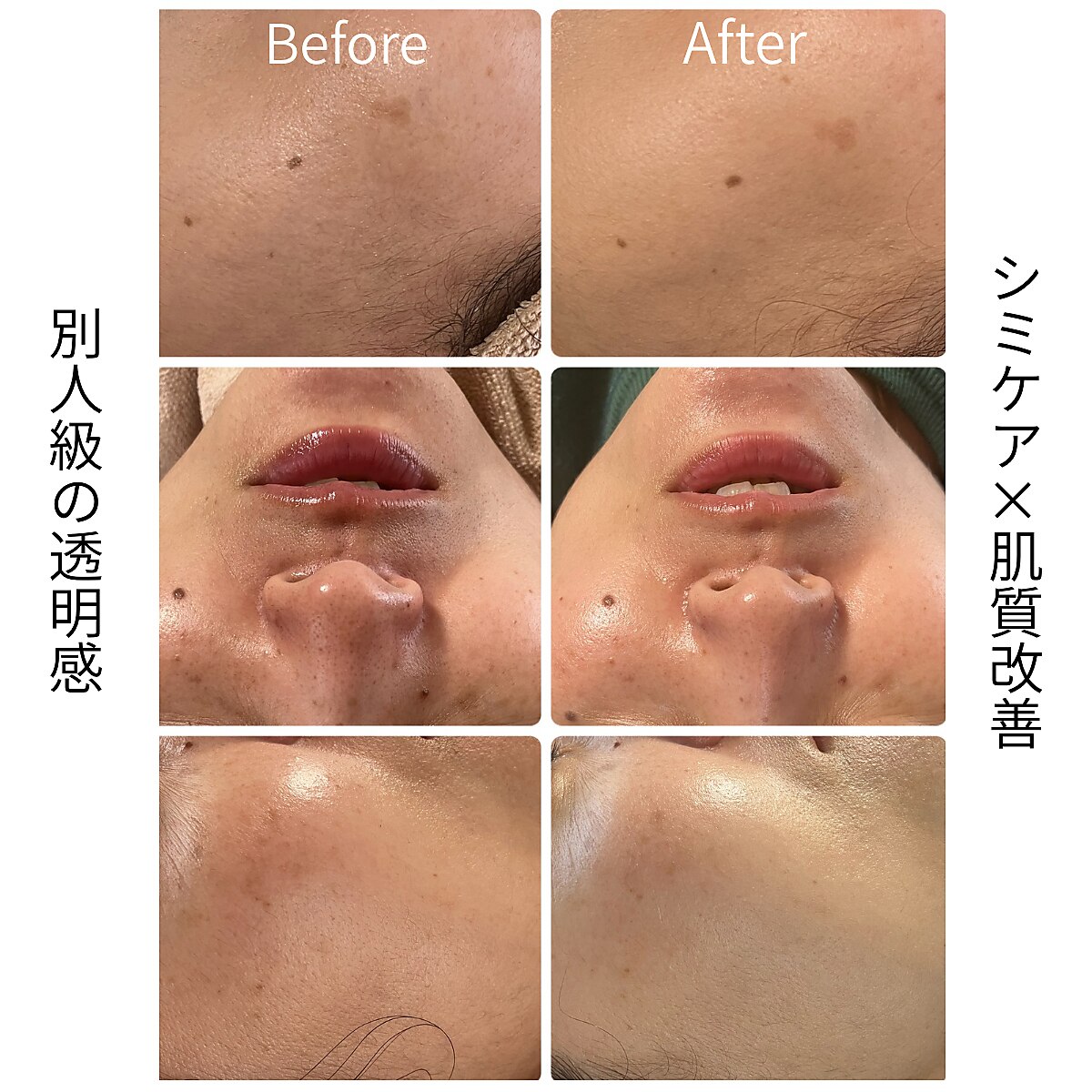 白の雫｜ホットペッパービューティー