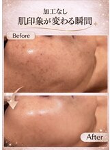 プリベンティブ ビューティー ティップス(Preventive Beauty Tips)/くすみ改善ビフォーアフター