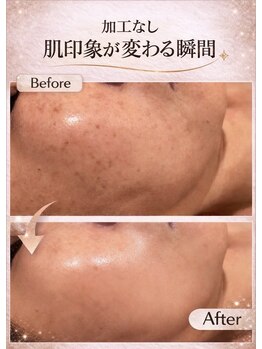 プリベンティブ ビューティー ティップス(Preventive Beauty Tips)/くすみ改善ビフォーアフター