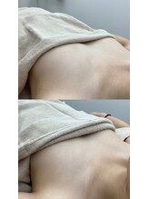 メリアミーゴ(Meli amigo)/大人気バストリリース20分