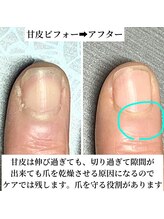 桃の木 吉祥寺店/ケア専門店は色は塗りません　3