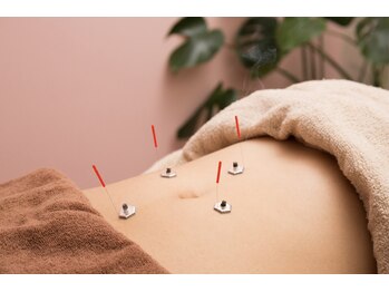 ハリプラス(HariPlus)/整体鍼灸[整体/整体鍼灸/肩こり]