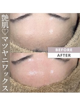 シン(sin)/一回で艶肌お約束