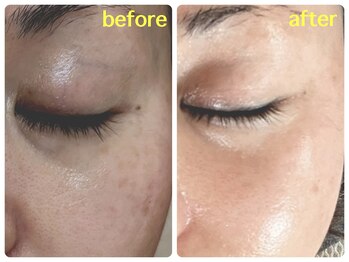 ベルドア(Bell Door)/エイジングケア◎