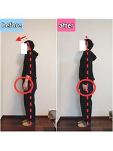 エンビジョン(ENVISION)/before→after