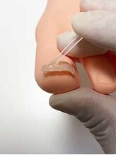 町田市巻き爪センター