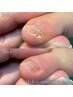 副爪１箇所（小指の爪横にある爪ではないモノ）【魚の目までケア】　¥5,500