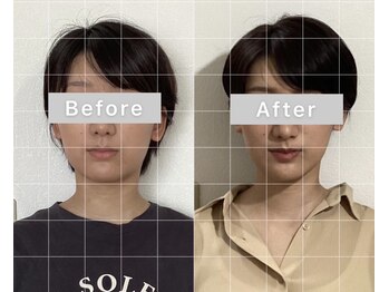 チャンス 西院(chance)/整体×美容鍼×小顔矯正/エラ