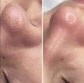 リラクゼーションアンドビューティーボヌール(BONHENR)