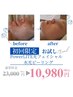 【フェイシャル人気NO.1☆】水光ピーリング×PowerLITE光フェイシャル¥10,980