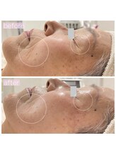 ペルラペティーユ(PERLA PETILLER)/スペシャルエイジングケア