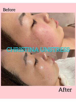 シュ シェリー(chou cherie)/CHRISTINA UNSTRESS