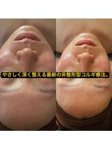 アロマビューティーサロン ジェイハウス(J)/