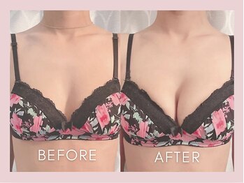 フェリーチェバスト 姫路店(FALICE)/憧れの美しい胸へ