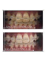 佐賀ホワイトニングラボ/