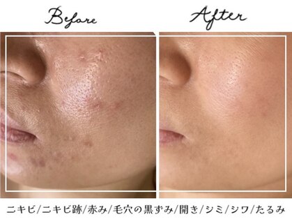 アリュール 倉敷(ALLURE)の写真