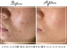 アリュール(ALLURE)