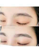 ファボ 宜野湾店(FAV)/ツルンとキレイな美肌へ