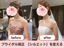 東広島あい整体院の雰囲気（ブライダル矯正で一生に一度の想いでをキレイなシルエットで♪）