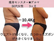 ファニービー 高槻店/症例写真