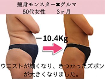 ファニービー 高槻店/症例写真