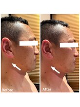 アディクト(Addict)/メンズのBefore＆After