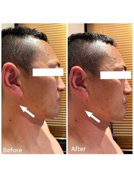 アディクト(Addict)/メンズのBefore＆After