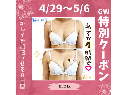エリマ(elima)の写真