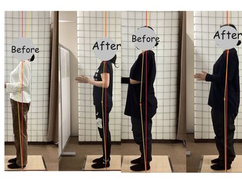 ヒューマン鍼灸接骨院/姿勢の変化を実感!