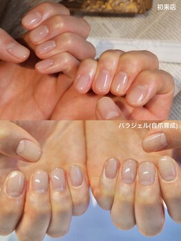 ニコプラス(NICO+)/自爪育成(クリア仕上げ)