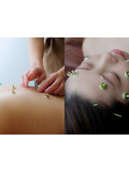 鍼灸施術を受けたい