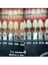 トウキョースワーズ 渋谷店(TOKYO SWRS)/#ホワイトニング #渋谷 #池袋