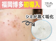 つるん肌。 福岡博多筑紫口店の雰囲気（シミケアで透明美肌へ☆医療提携サロンでシミケアを!福岡希少♪）