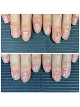 ウェルズユキ(well's yuki)/白い部分の爪しか伸びない