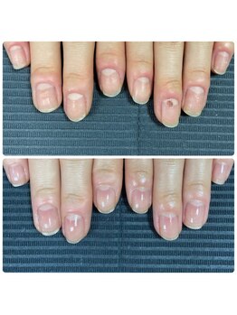 ウェルズユキ(well's yuki)/白い部分の爪しか伸びない