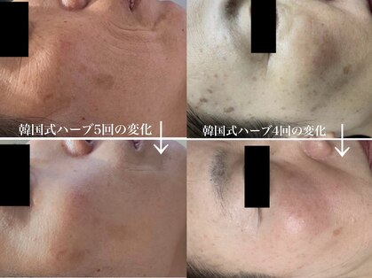 リラ(Lilas)の写真