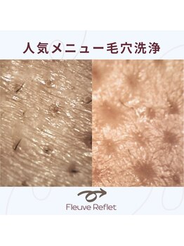 フルーヴ ルフレ(Fleuve Reflet)/肌質改善☆まずは毛穴掃除から☆