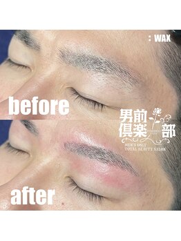 男前倶楽部/脱毛/メンズ脱毛/メンズ専門店