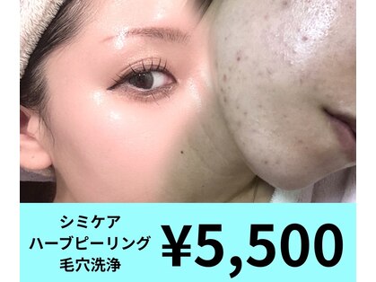アキネ(Akine.)の写真