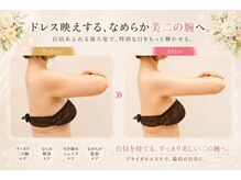ぷれじーるの雰囲気（筋膜&むくみケアに効果的◎神の手マシン【トランスフォーマー】）