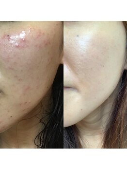 モミ 高崎緑町店(momi)/ラテスパ