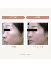 サロン メイリー(salon meili)/セラムによるフェイシャルケア