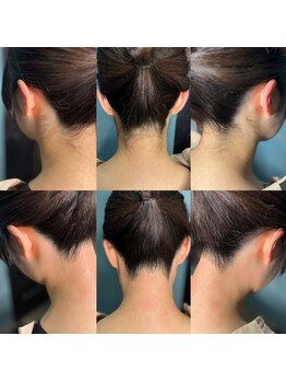 シュシュ 梅田店(+Chou chou)/うなじ脱毛