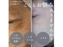 サロンドアモール(Salon de a mole)