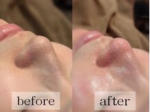 グランビューティ(Glanz Beauty)/20代女性