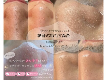 ラウレア(Laule’an)の写真