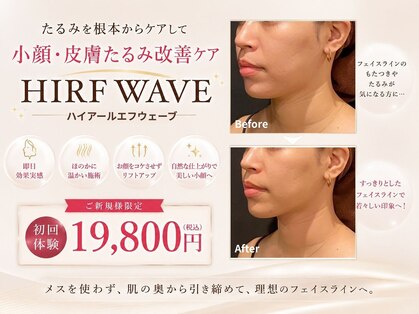 ミエル 神戸店(Miel)の写真