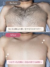アルゴ 柳川店(ALGO) ビフォー アフター